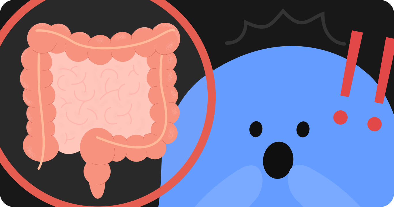 睡眠不足が便秘の原因であることを説明するイラスト