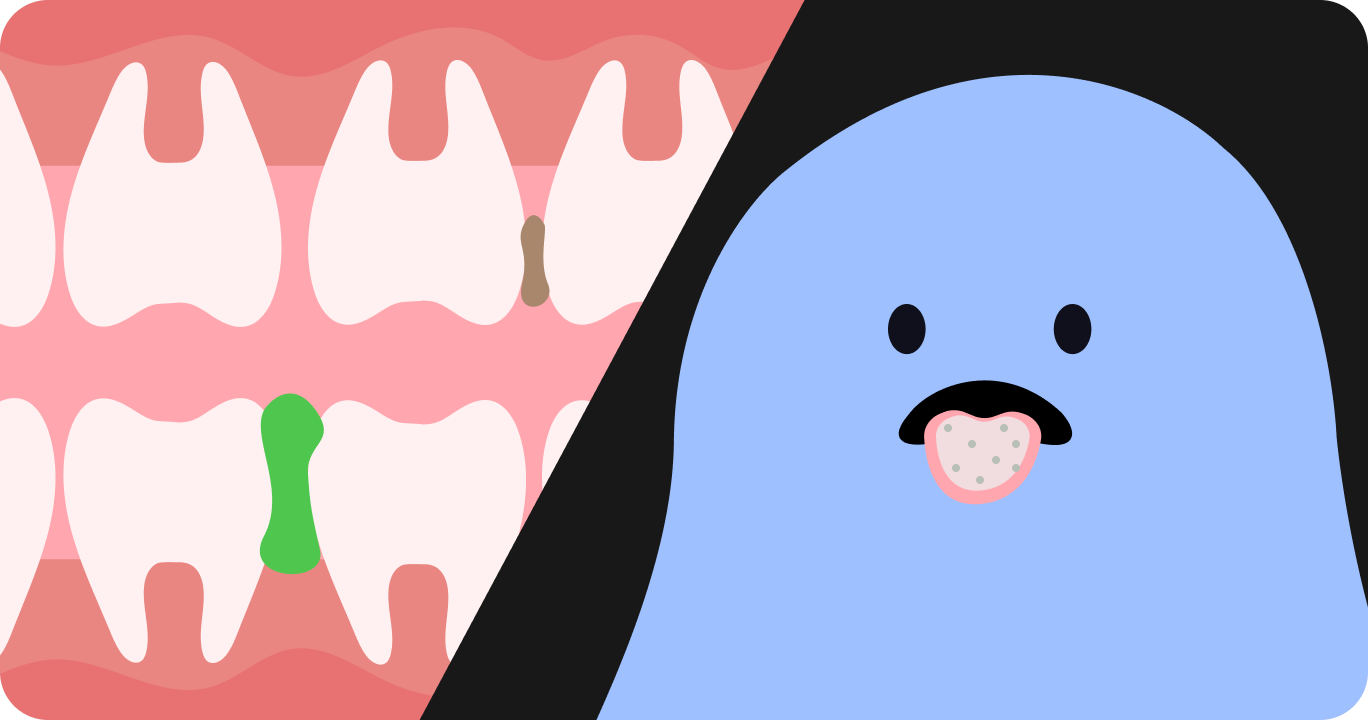 一晩で口の中に細菌が増殖している様子